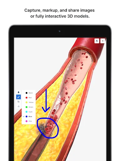 BioDigital Human ডাউনলোড করুন – সেরা 3D অ্যানাটমি লার্নিং অ্যাপ - Screenshot 17